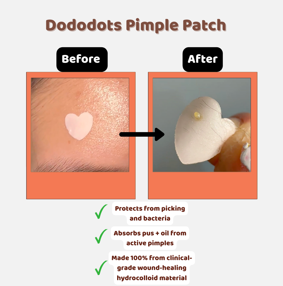 Pimple Patch Starter Kit